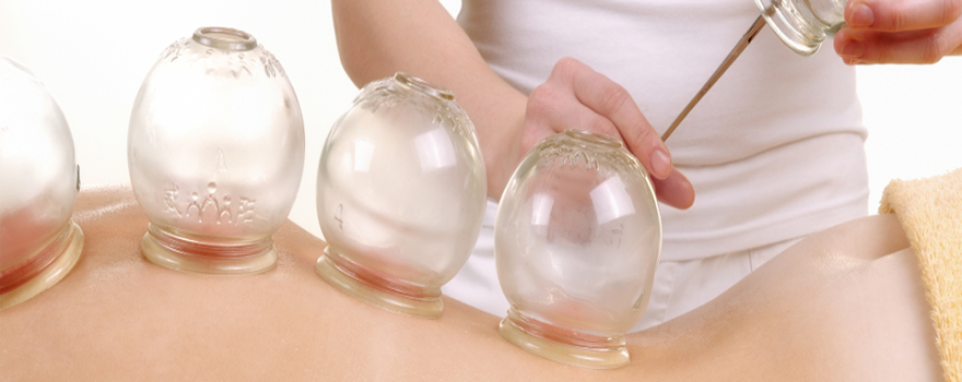 Cupping Therapy Cupping Therapy