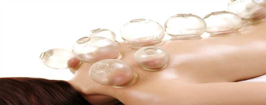 Cupping Therapy Cupping Therapy
