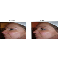 Caci Results