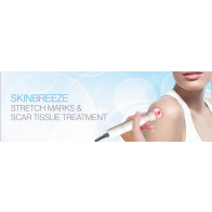 Skinbreeze Stretch Marks & Scar Tissue